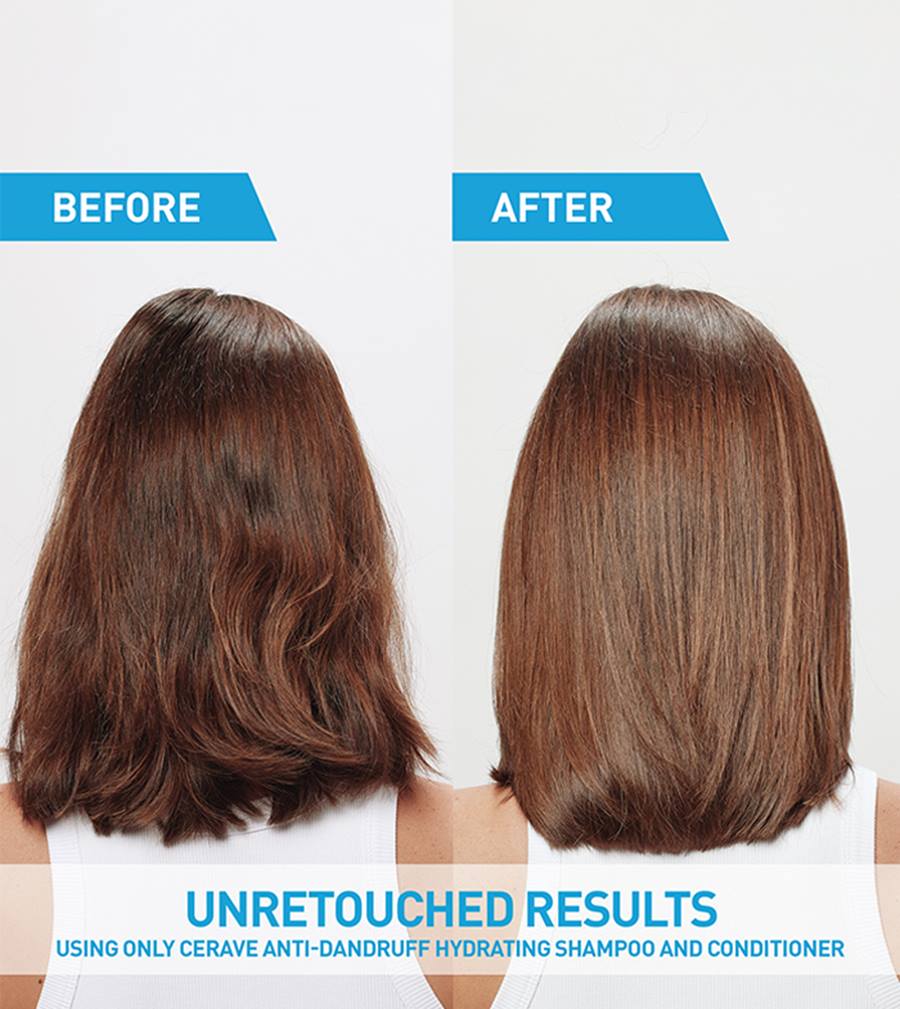CeraVe Anti-Dandruff Hydrating Shampoo - Image 3