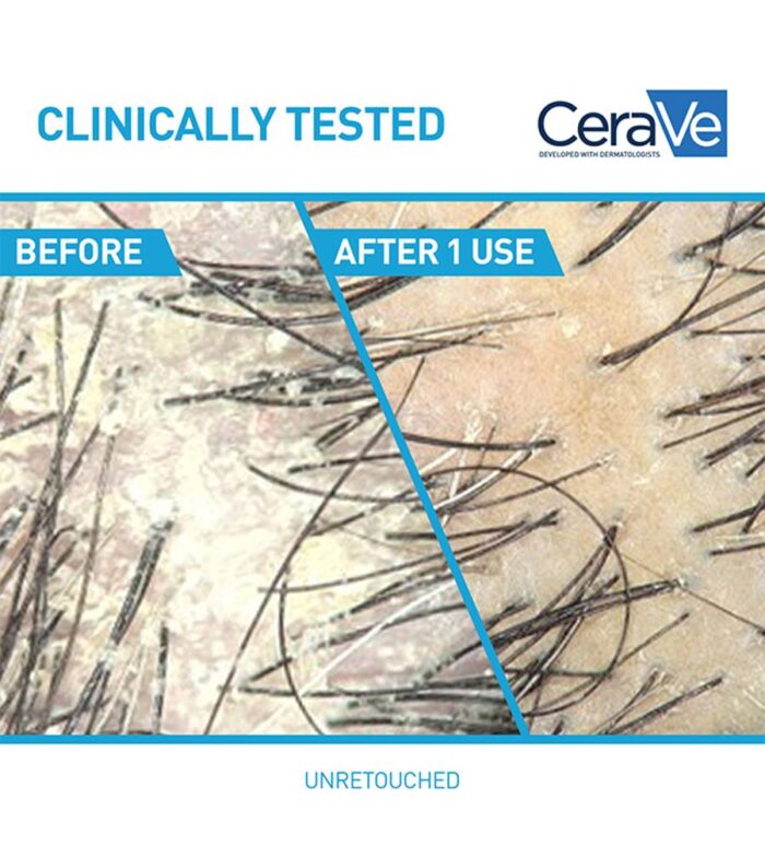 Cerave Anti-Dandruff Hydrating Conditioner - Image 3