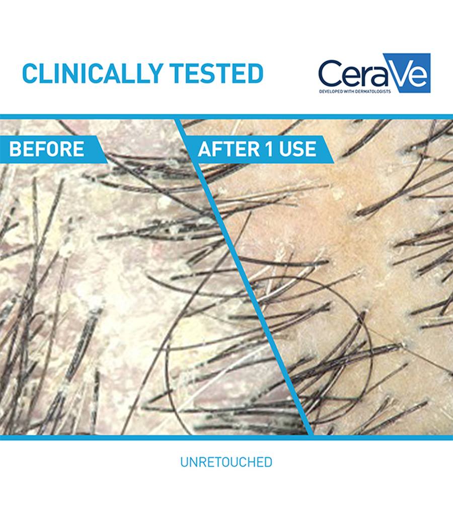 CeraVe Anti-Dandruff Hydrating Shampoo - Image 4
